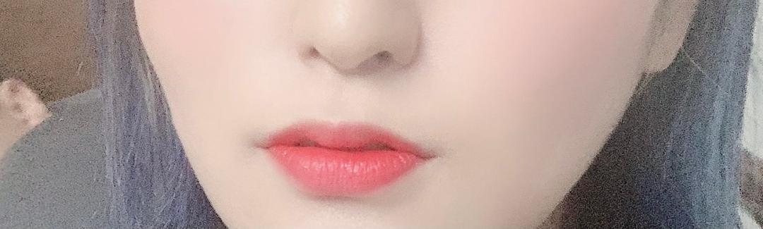 입꼬리성형 후기