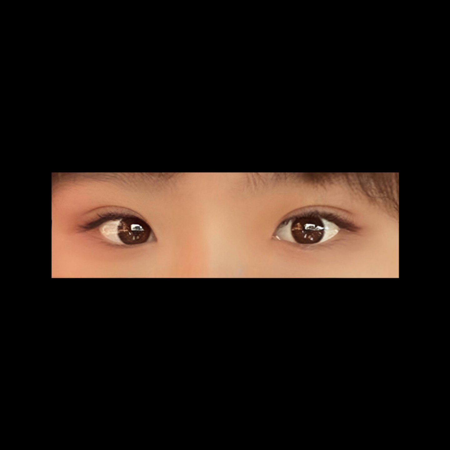 밑트임 후기