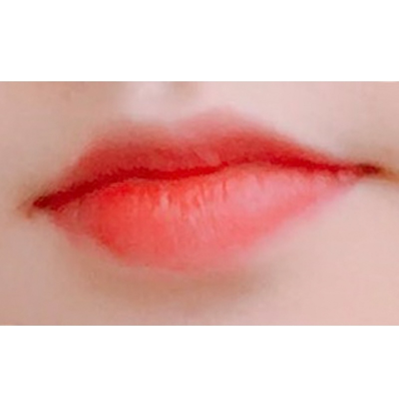 입꼬리성형 후기