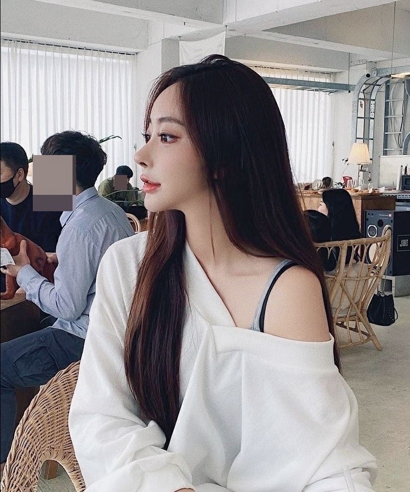 눈재수술 후기