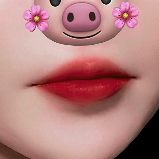 입꼬리성형 후기