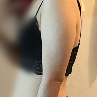 팔지방흡입 후기