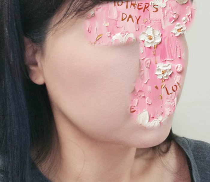 실리프팅 후기