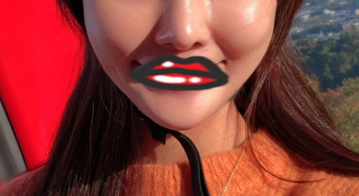 실리프팅 후기