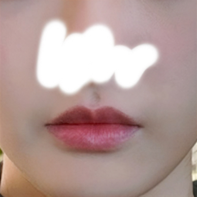 큐피트라인성형 후기
