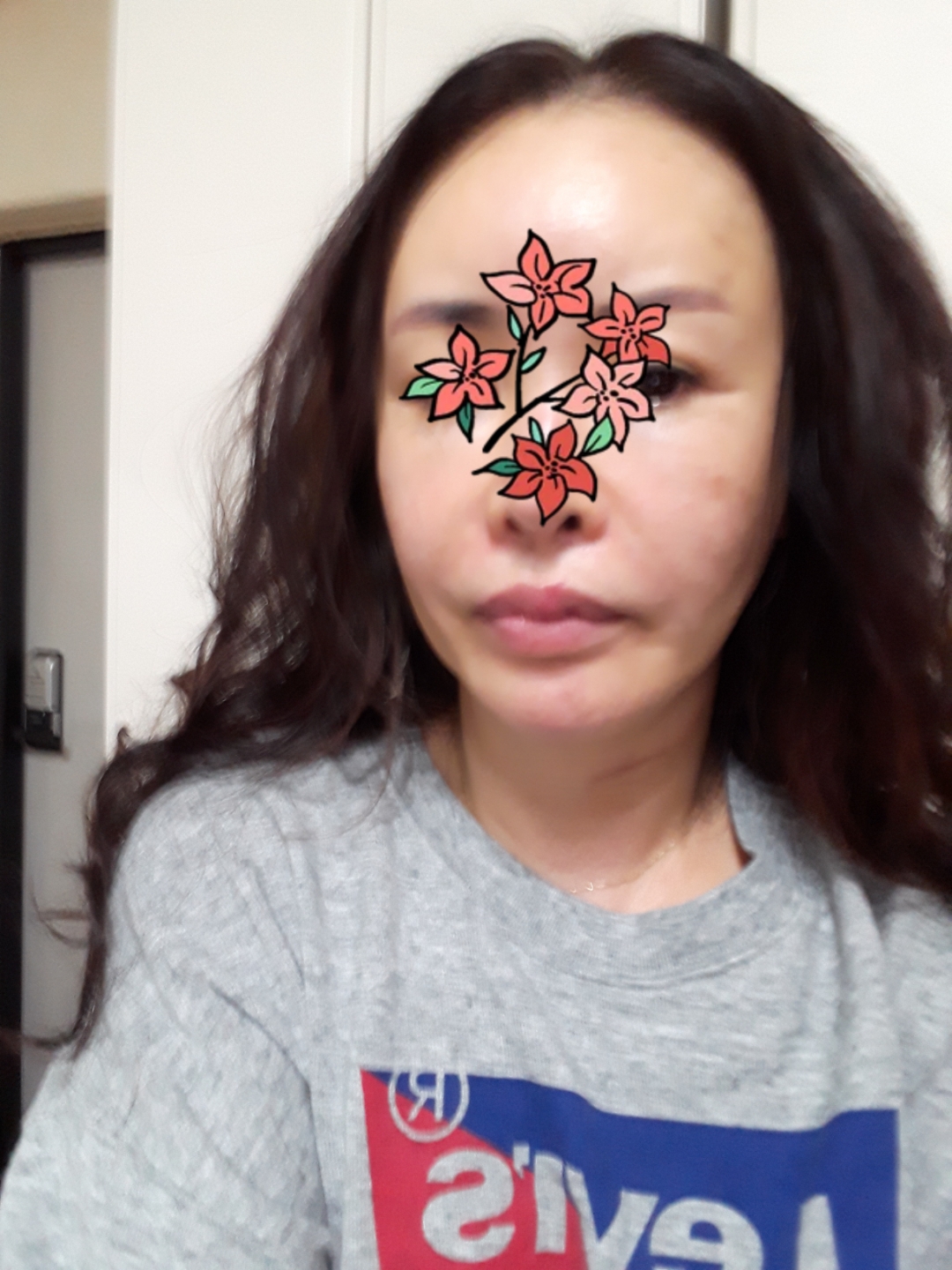 실리프팅 후기