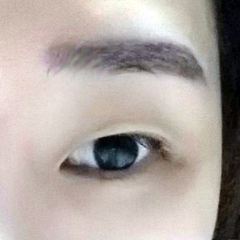 쌍꺼풀(자연유착) 후기