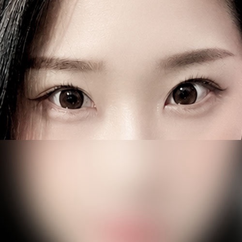 밑트임 후기