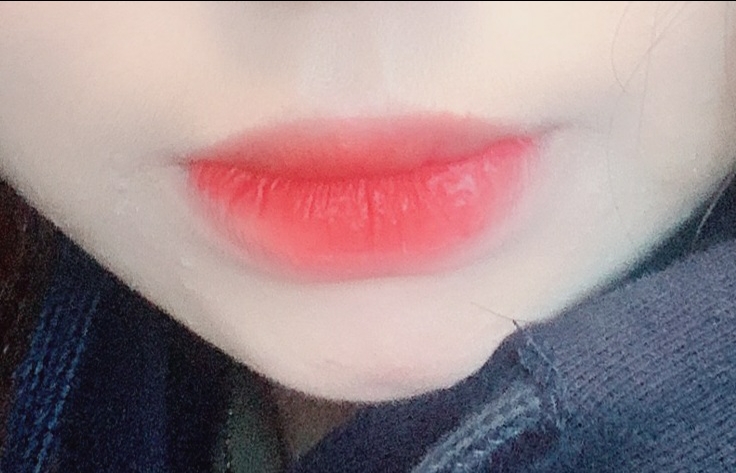 입꼬리성형 후기