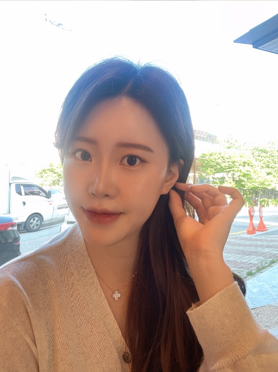 눈재수술 후기