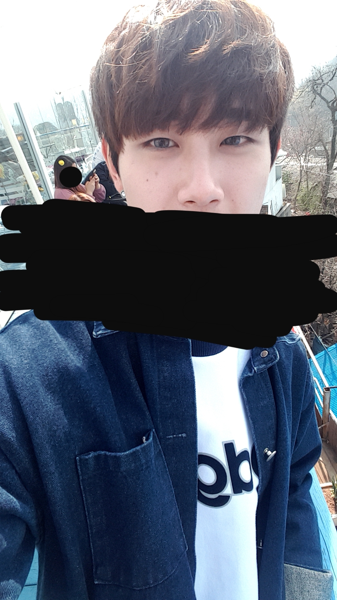 콧대(보형물) 후기
