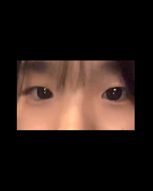 밑트임 후기