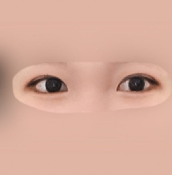 밑트임 후기