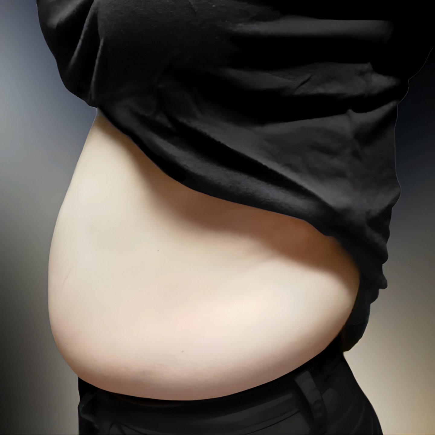 러브핸들지방흡입 후기