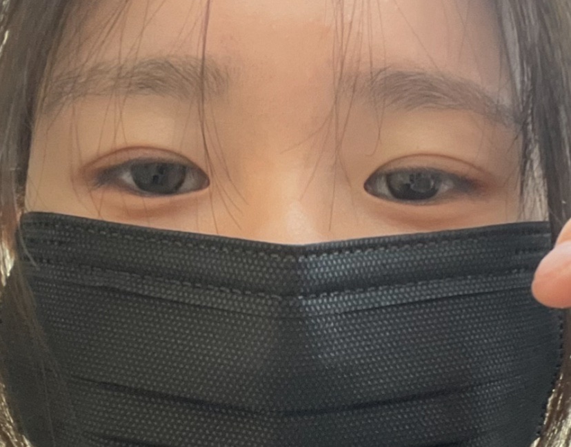 밑트임 후기
