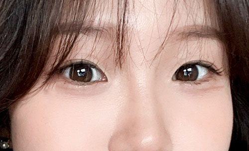 밑트임 후기