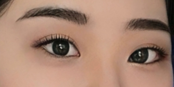 밑트임 후기