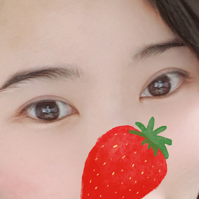 눈재수술 후기