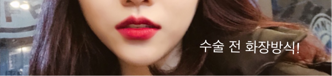 입꼬리성형 후기