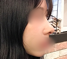 얼굴에 입체감이 생겼어요ㅋㅋ
