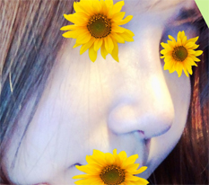 콧대가 높아졌어요 히힣