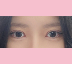 선명한 라인으로 종결