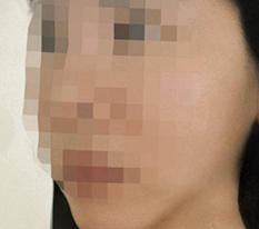 두턱 사라졌어옄ㅋ