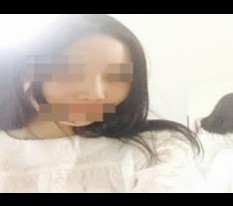 고민하다가 한 코성형 후기