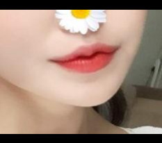 입꼬리 성형했어요♡