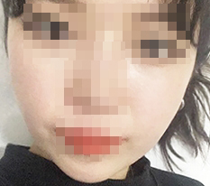 광대축소