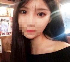 눈성형 전 과 후 완전 비교되는 후기!!