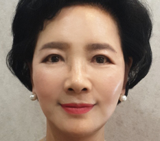 한평생 고생만한 우리엄마를 위해 안면거상 수술 시켜드렸는데 너무 행복해하시네요