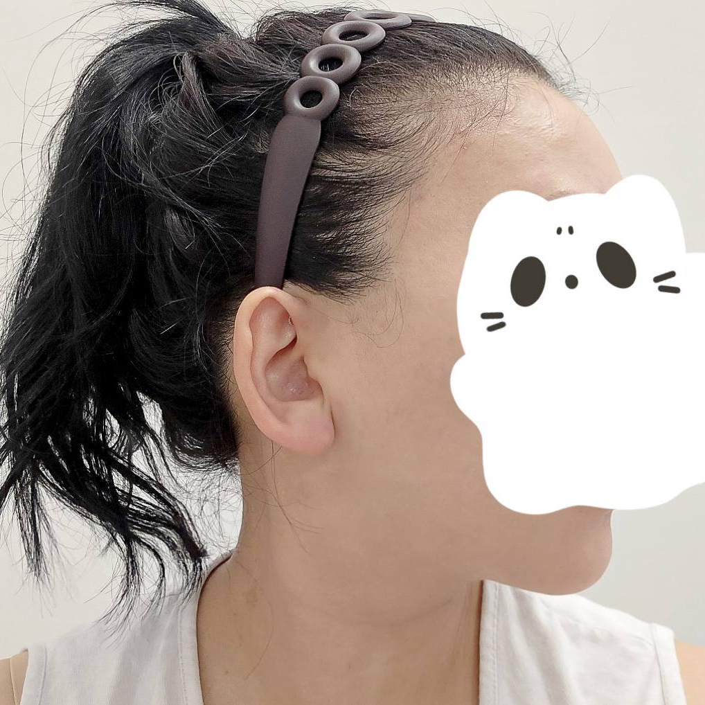 얼굴+이중턱지흡 레전드 얼지흡 턱지흡 알아보는 분들 꼭 보세요