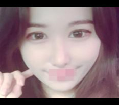 눈, 코, 지방흡입 후기