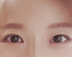 신의 한수 였던 눈