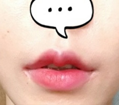 입매 예뻐지지 않았나요?ㅋ