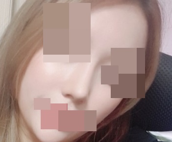코수술후기