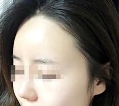 내것아닌 내것같은 내이마 : )