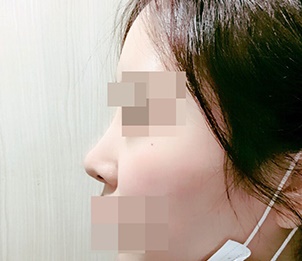 재수술은 성공했어요'< '♥