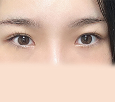 인상 깔끔해졌다네요ㅎㅎ