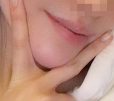 턱끝수술 받고 얼굴갸름해진건 기본이고 이미지가 바꼈어용