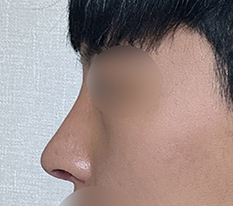전후 확실하네요