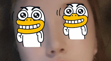 현대미학에서 코성형했어요^^