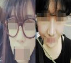 없던 콧대 생겨서 사람됐어요 ㅋㅋㅋ