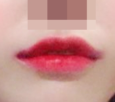 입꼬리성형 덕분이에요!