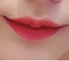 입꼬리수술 하고 인상 마니 달라졌어용 ㅎㅎ