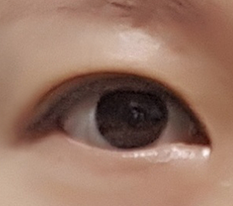 눈교쌍수 4개월차~^^