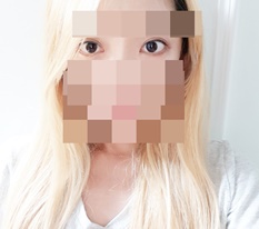 눈 보정 이젠 필요 없지롱~ㅋㅋ