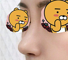코재수술 만족도가 이렇게 높을지 몰랐네용 ㅎㅎ