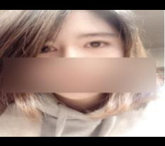 쌍꺼풀절개, 앞트임. 코비중격수술 간단후기 올려용